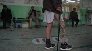 In this photograph taken on February 13, 2018 shows an Afghan amputee walking with his prosthetic leg at a hospital run by the International Committee of the Red Cross (ICRC) for war victims and the disabled in Kabul