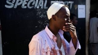 An injured Somali shopkeeper looks on outside his shop in the South African township of Soweto