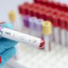 HIV vaccine displays promise in human trial