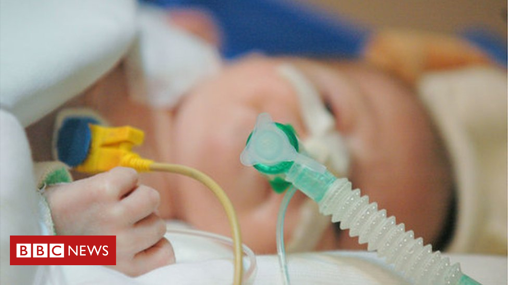 Ill small children in peril from loss of respiring tube monitoring