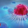 Artificial intelligence used to predict cancer enlargement