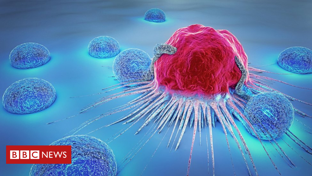 Artificial intelligence used to predict cancer enlargement