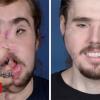 Cameron Underwood: Face transplant manner i will be able to smile again