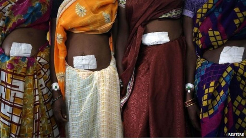 India sterilisation 'drunk' doctor suspended