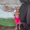 Yemen predicament: EIGHTY FIVE,000 kids 'dead from malnutrition'