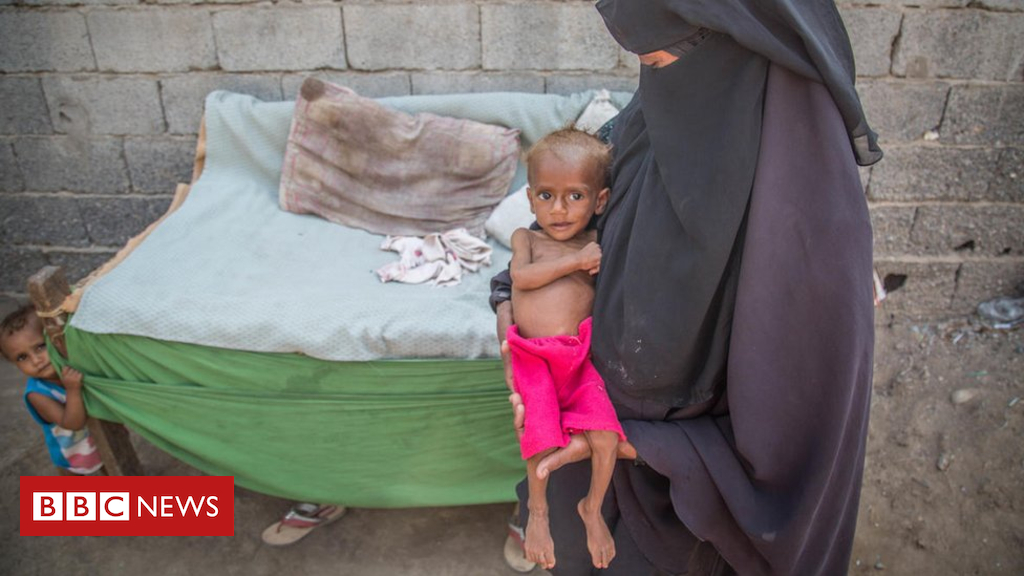 Yemen predicament: EIGHTY FIVE,000 kids 'dead from malnutrition'