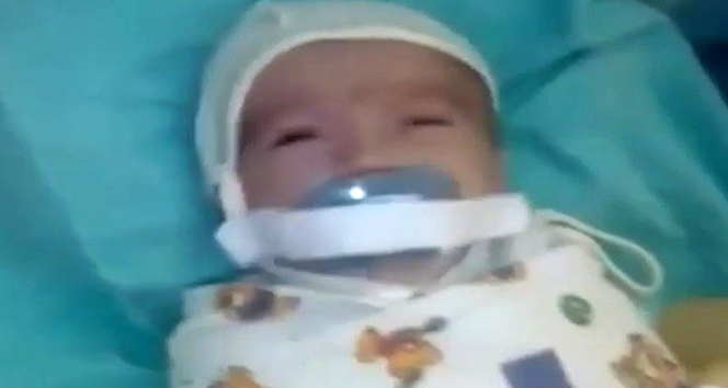 Nipple torture a baby in an incubator in Russia